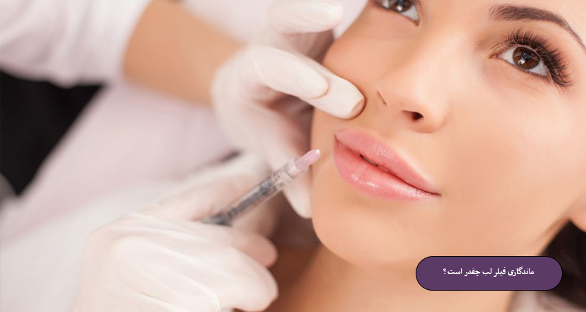 ماندگاری فیلر لب
