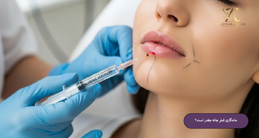 ماندگاری-فیلر-چانه-چقدر-است؟