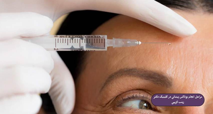 مراحل-انجام-بوتاکس-پیشانی-در-کلینیک-دکتر-زینب-کریمی