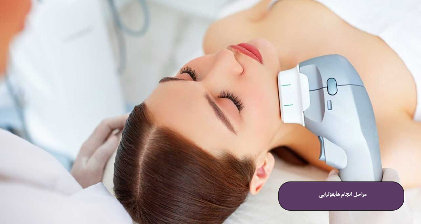 مراحل انجام هایفوتراپی