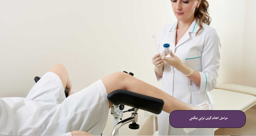 مراحل انجام کربن تراپی بیکینی