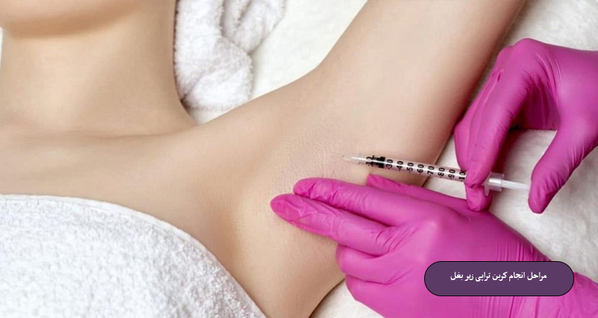 مراحل انجام کربن تراپی زیر بغل