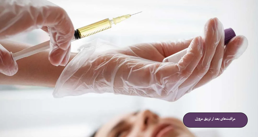 مراقبت های بعد از تزریق مزوژل