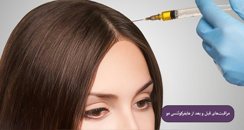 مراقبت‌های قبل و بعد از هایفرکوئنسی مو