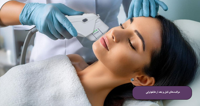 مراقبت‌های قبل و بعد از هایفوتراپی