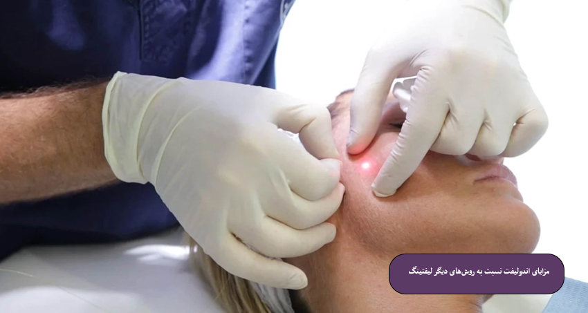 مزایای اندولیفت