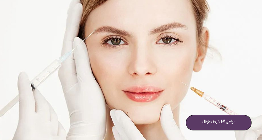 عوارض مزوژل صورت