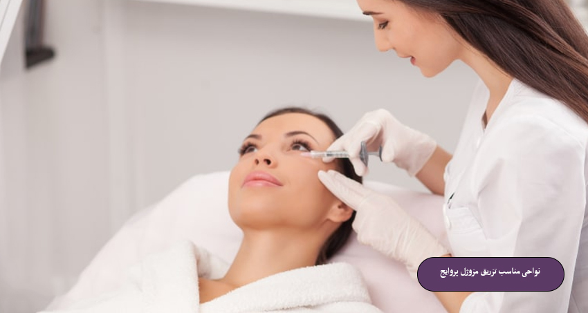 نواحی-مناسب-تزریق-مزوژل-پروایج