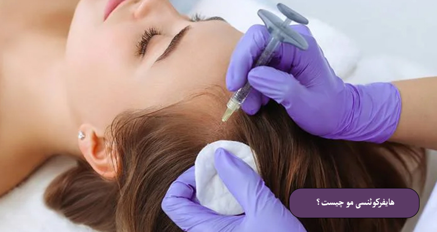 هایفرکوئنسی مو چیست