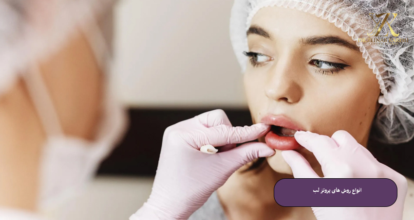 انواع روش‌ های پروتز لب