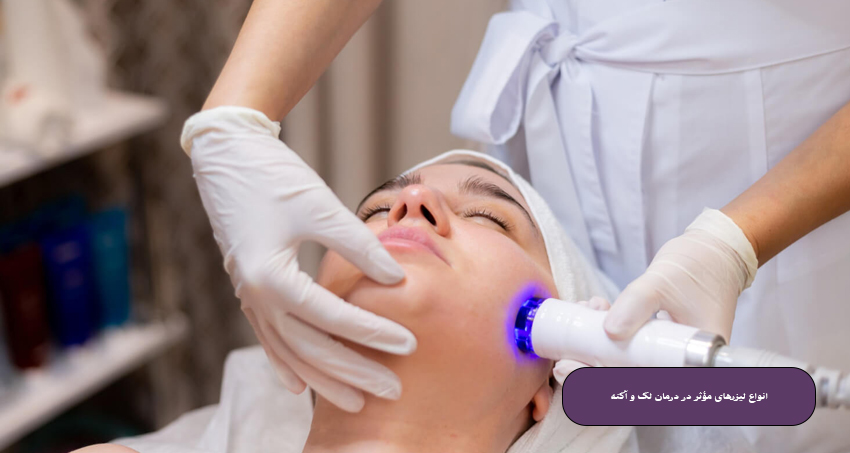 انواع لیزرهای مؤثر در درمان لک و آکنه
