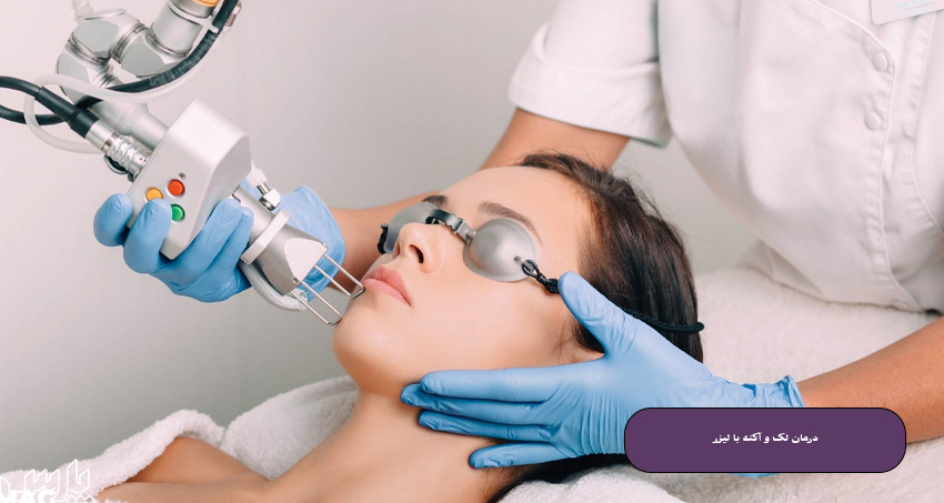 درمان لک و آکنه با لیزر