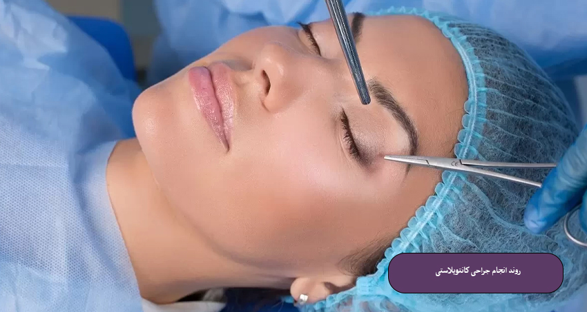 روند انجام جراحی کانتوپلاستی