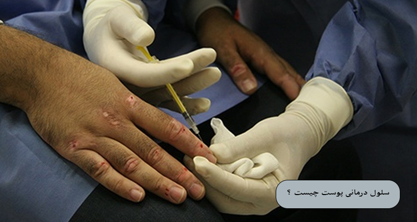 فرآیند سلول ‌درمانی پوست چگونه انجام می ‌شود ؟