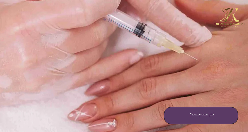 فیلر-دست-چیست؟