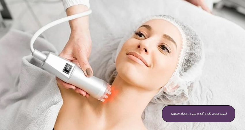 قیمت درمان لک و آکنه با لیزر در مبارکه اصفهان