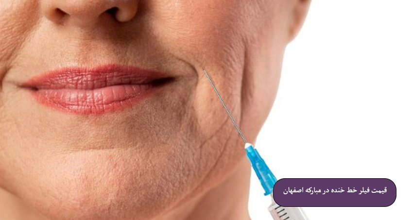 قیمت فیلر خط خنده در مبارکه اصفهان