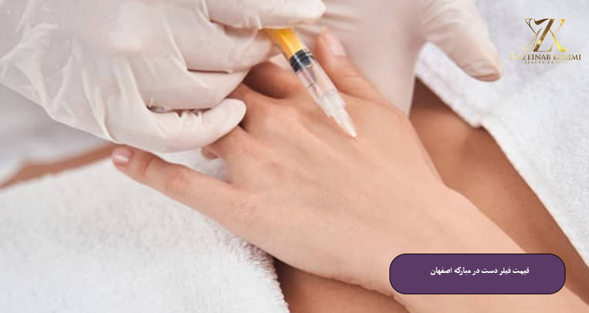 قیمت-فیلر-دست-در-مبارکه-اصفهان