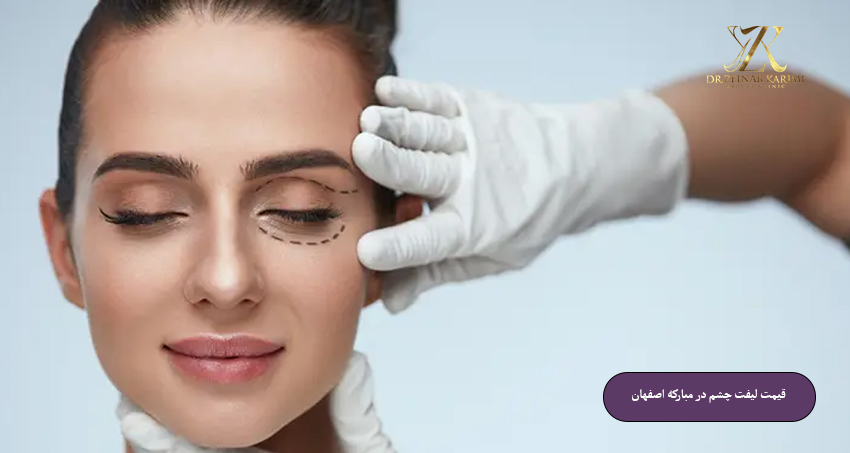 قیمت-لیفت-چشم-در-مبارکه-اصفهان