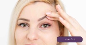 لیفت پلک بدون جراحی