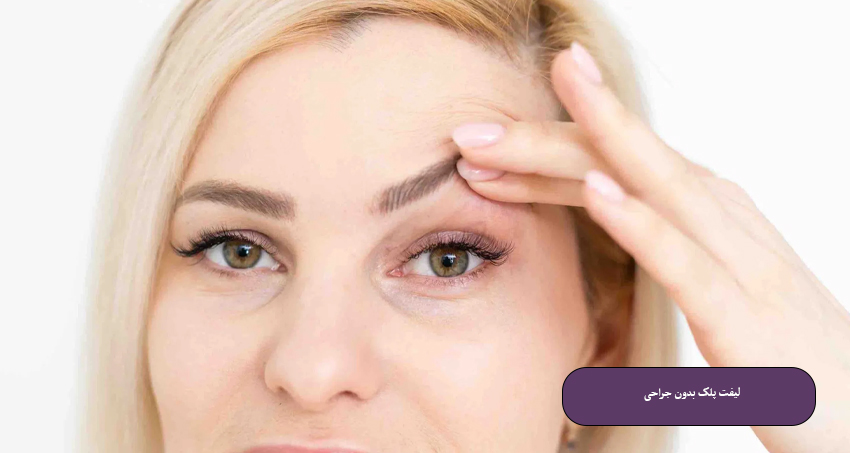 لیفت پلک بدون جراحی