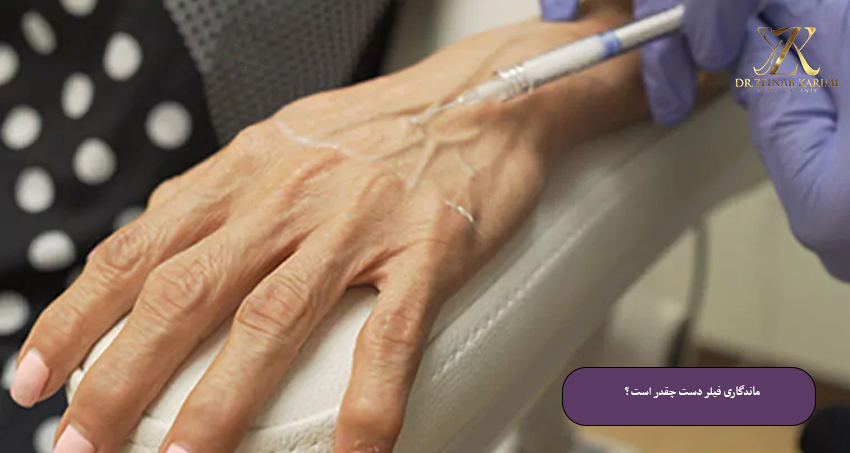 ماندگاری-فیلر-دست-چقدر-است؟