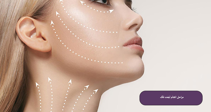 مراحل انجام لیفت فک