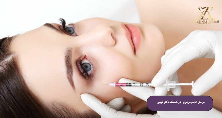 مراحل انجام مزوتراپی در کلینیک دکتر کریمی