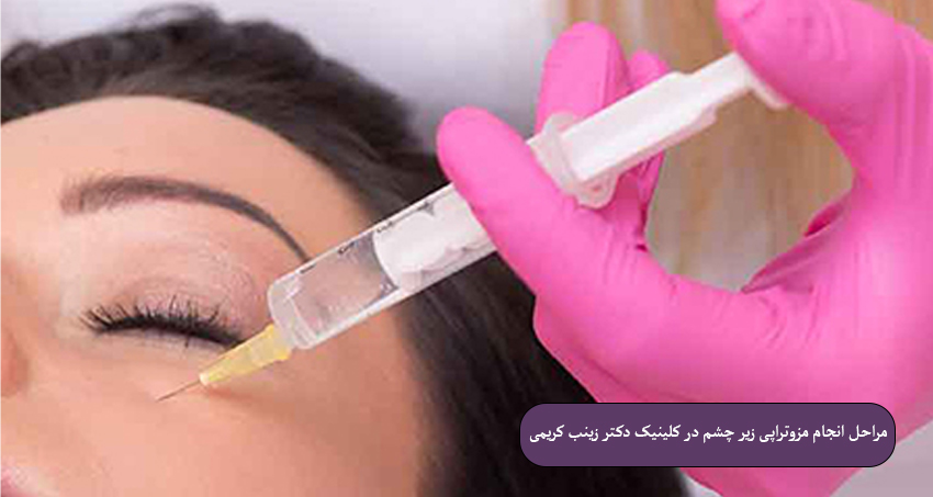 مراحل-انجام-مزوتراپی-زیر-چشم-در-کلینیک-دکتر-زینب-کریمی