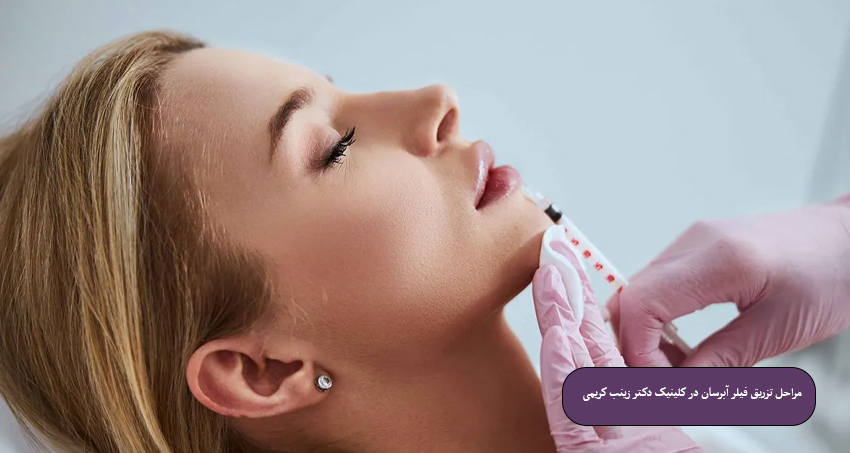 مراحل تزریق فیلر آبرسان در کلینیک دکتر زینب کریمی