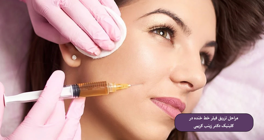 مراحل تزریق فیلر خط خنده در کلینیک دکتر زینب کریمی