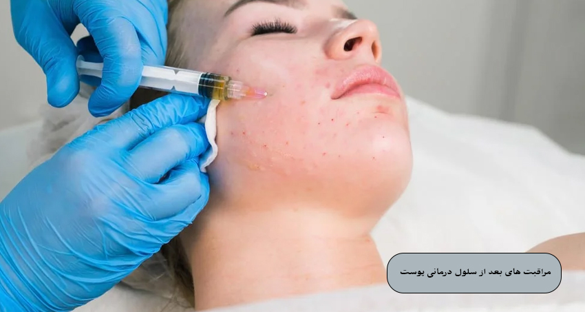 مراقبت‌ های بعد از سلول ‌درمانی پوست