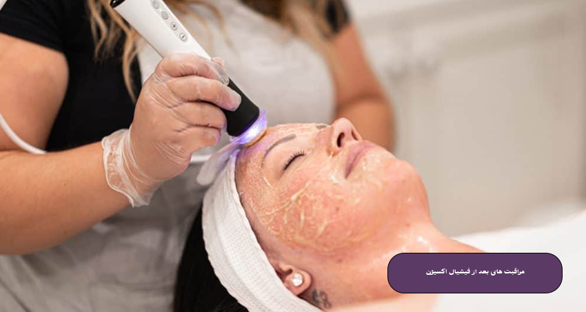 مراقبت‌ های بعد از فیشیال اکسیژن