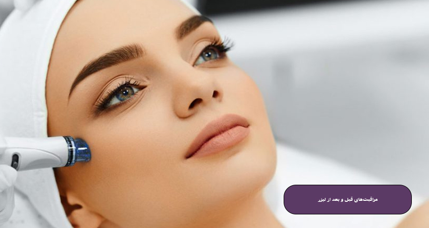 مراقبت‌های قبل و بعد از درمان لک و آکنه با لیزر