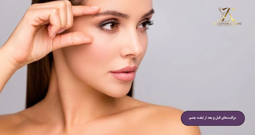 مراقبت‌های-قبل-و-بعد-از-لیفت-چشم