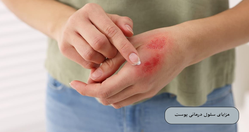 مزایای سلول ‌درمانی پوست