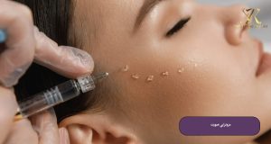 مزوتراپی صورت