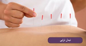 نیدل‌ تراپی