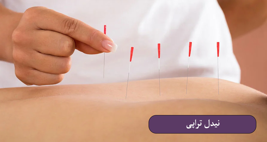 نیدل‌ تراپی