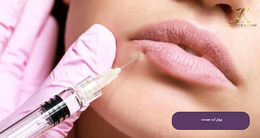 پروتز لب چیست؟