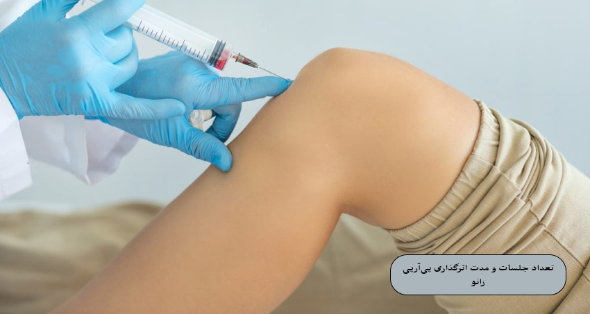 تعداد جلسات و مدت اثرگذاری درمان پی‌ آر‌ پی زانو