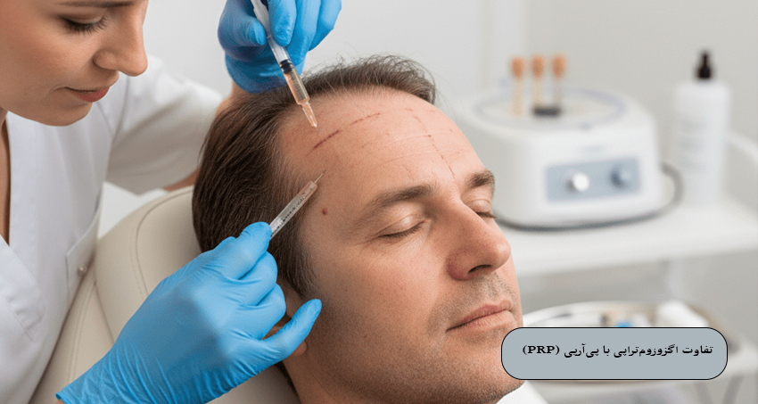تفاوت اگزوزوم‌ تراپی با پی‌آرپی (PRP)