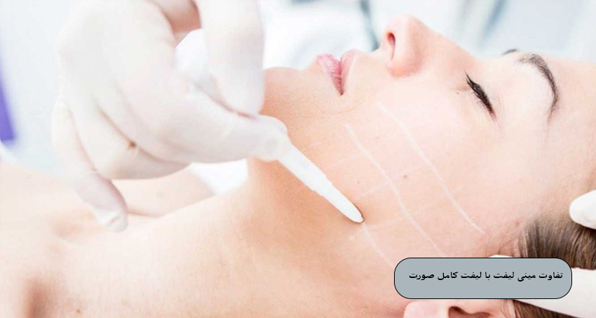 تفاوت مینی لیفت با لیفت کامل صورت