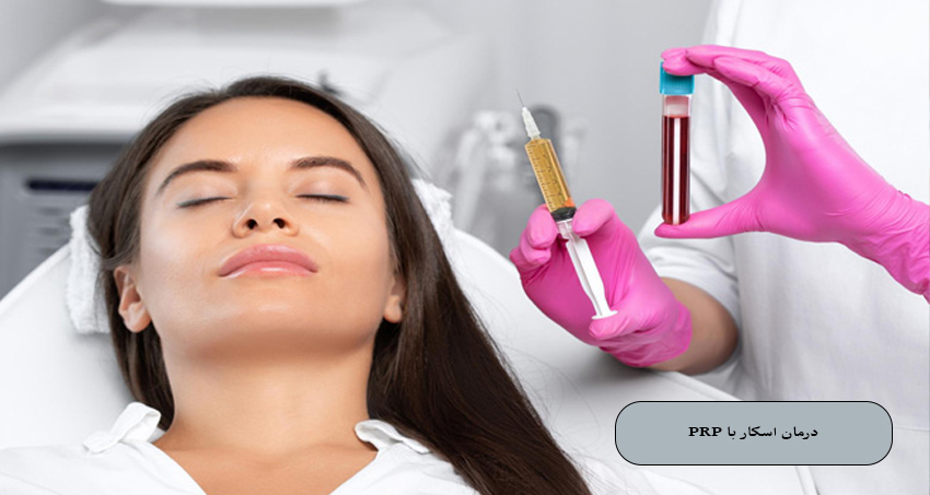 درمان اسکار با PRP