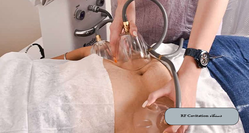 لاغری با دستگاه RF Cavitation