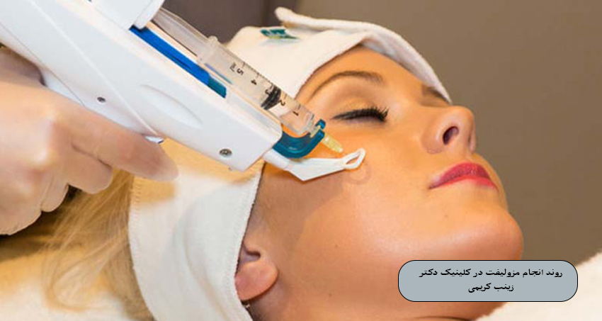 روند انجام مزولیفت صورت در کلینیک دکتر زینب کریمی