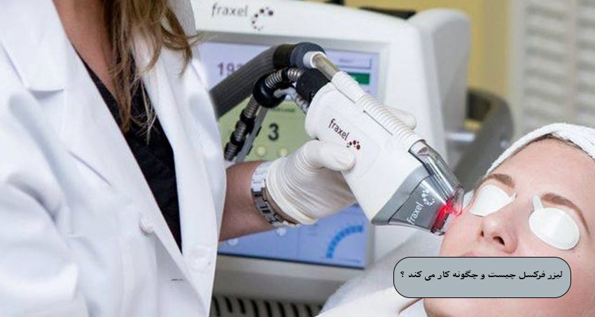 لیزر فرکسل چیست و چگونه کار می ‌کند ؟