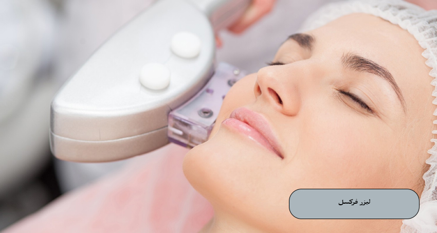 لیزر فرکسل