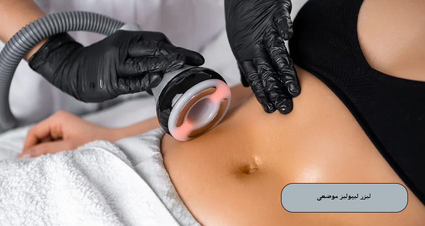 لیزر لیپولیز موضعی