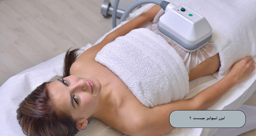 لیزر لیپولیز چیست؟